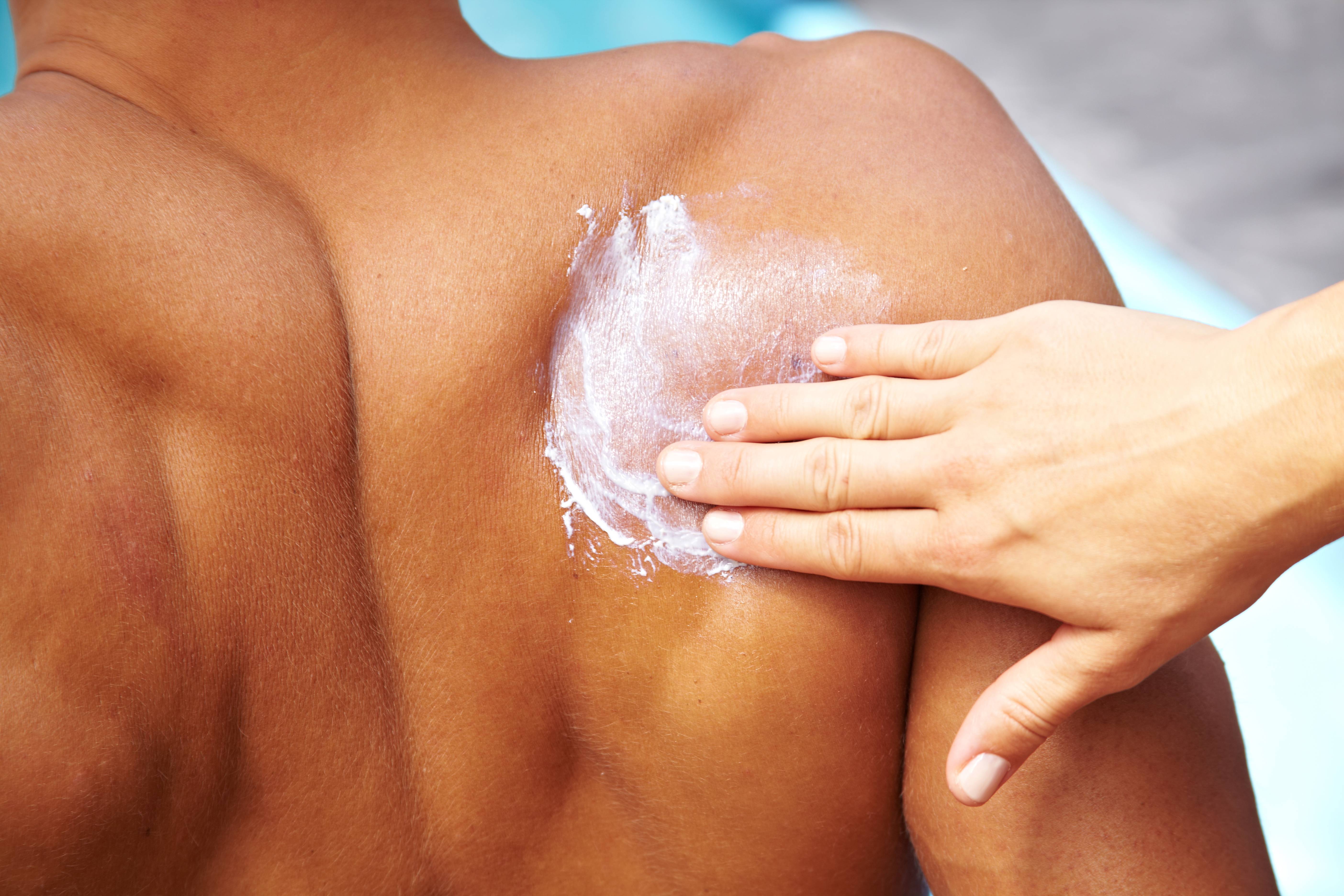 Eine Hand trägt Sonnencreme auf den Rücken einer Person auf.